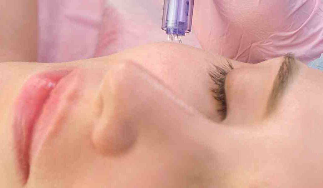 مزوتراپی چیست؟ مزایا، معایب و کاربردها